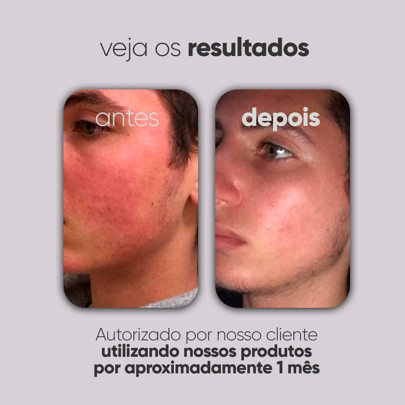 Kit Personalizado TI3JH854D05