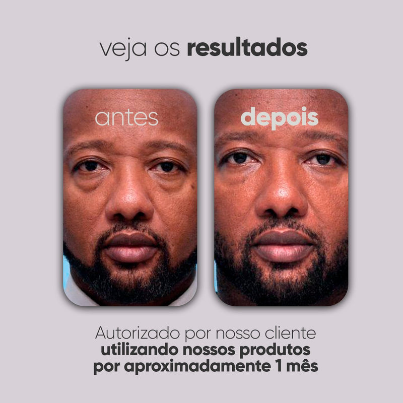 Kit Personalizado TI3JH854D08