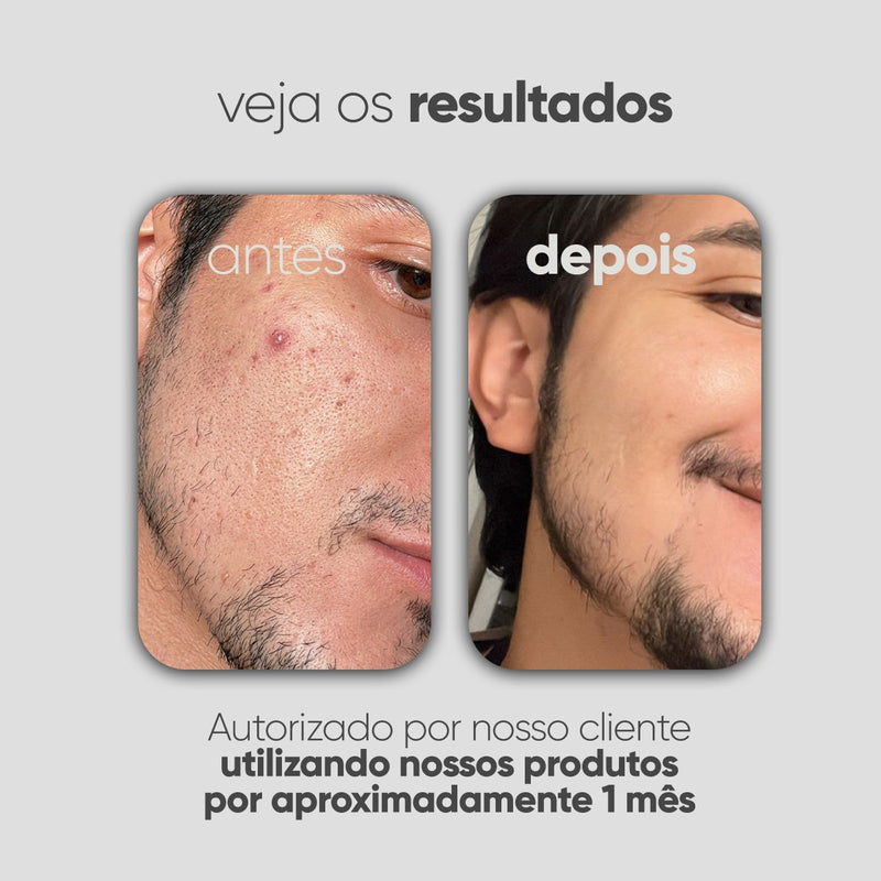 Kit Personalizado TI3JH854D07