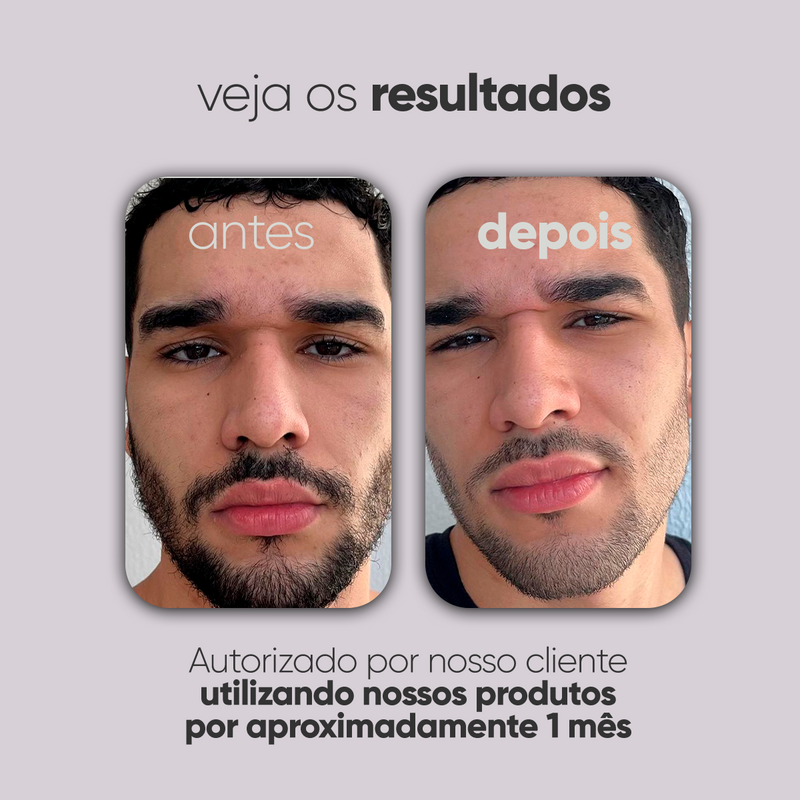 Kit Personalizado TI3JH854D03