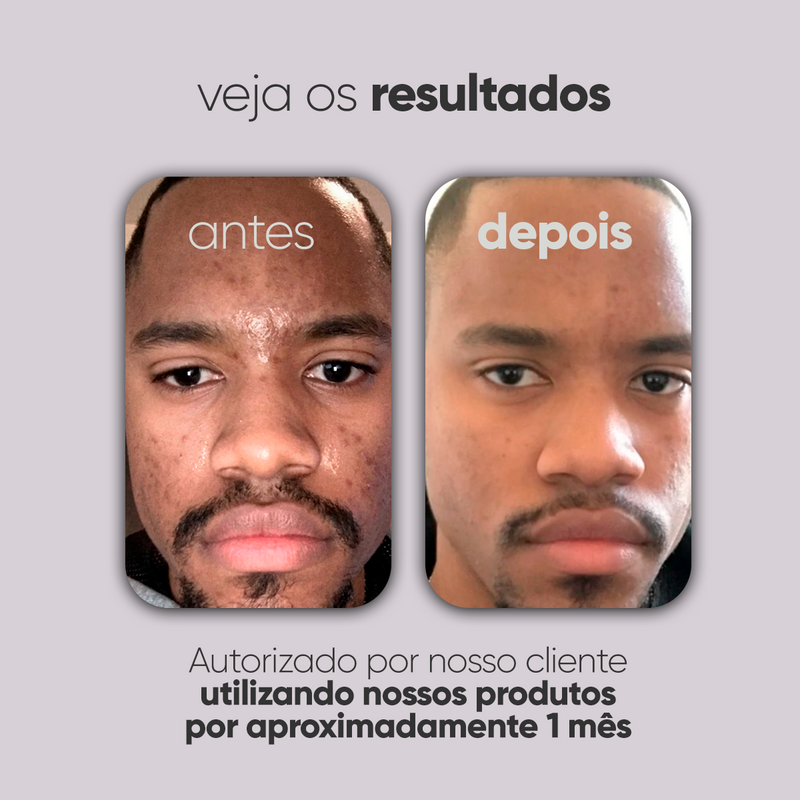 Kit Personalizado TI3JH854D02