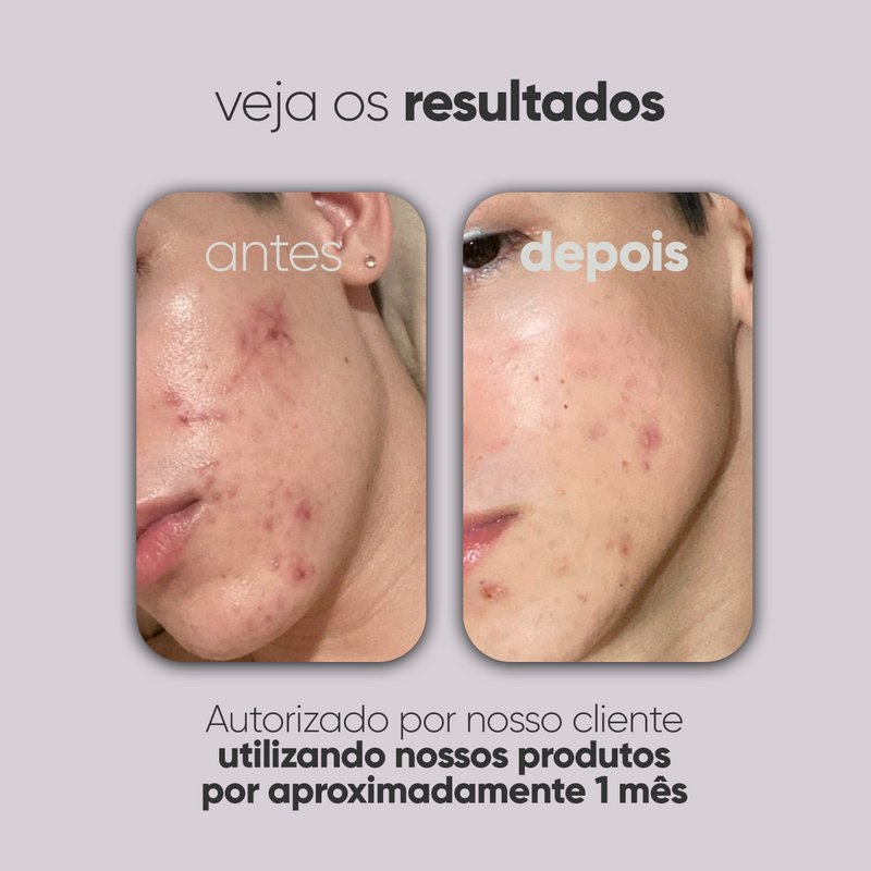 Kit Personalizado TI3JH854D02