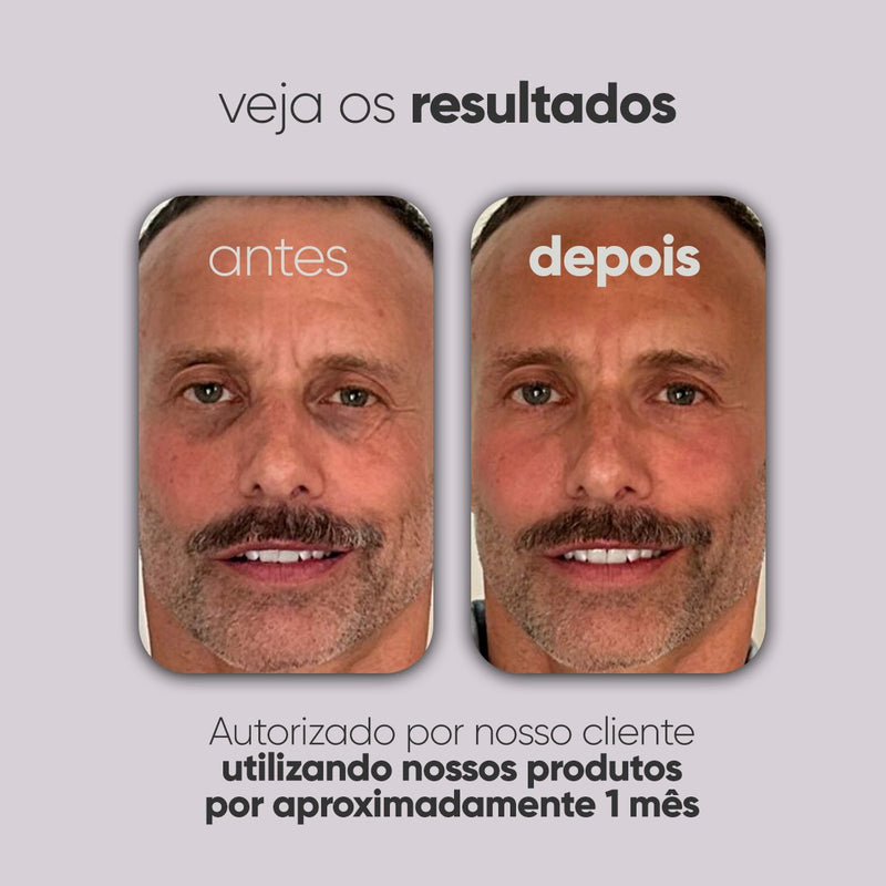 Kit Personalizado TI3JH854D08