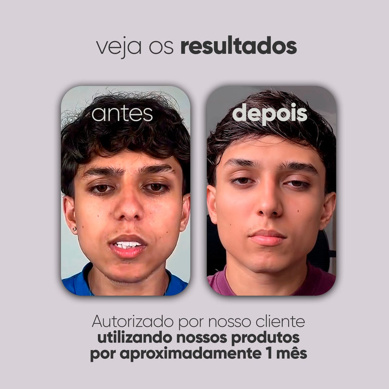 Kit Personalizado TI3JH854D08