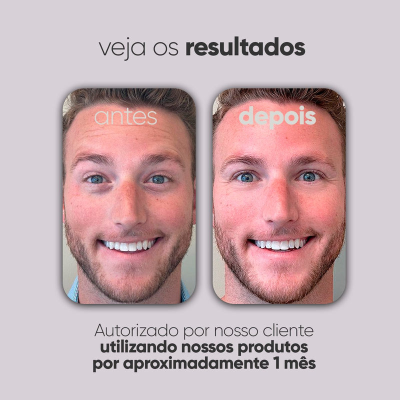 Kit Personalizado TI3JH854D06