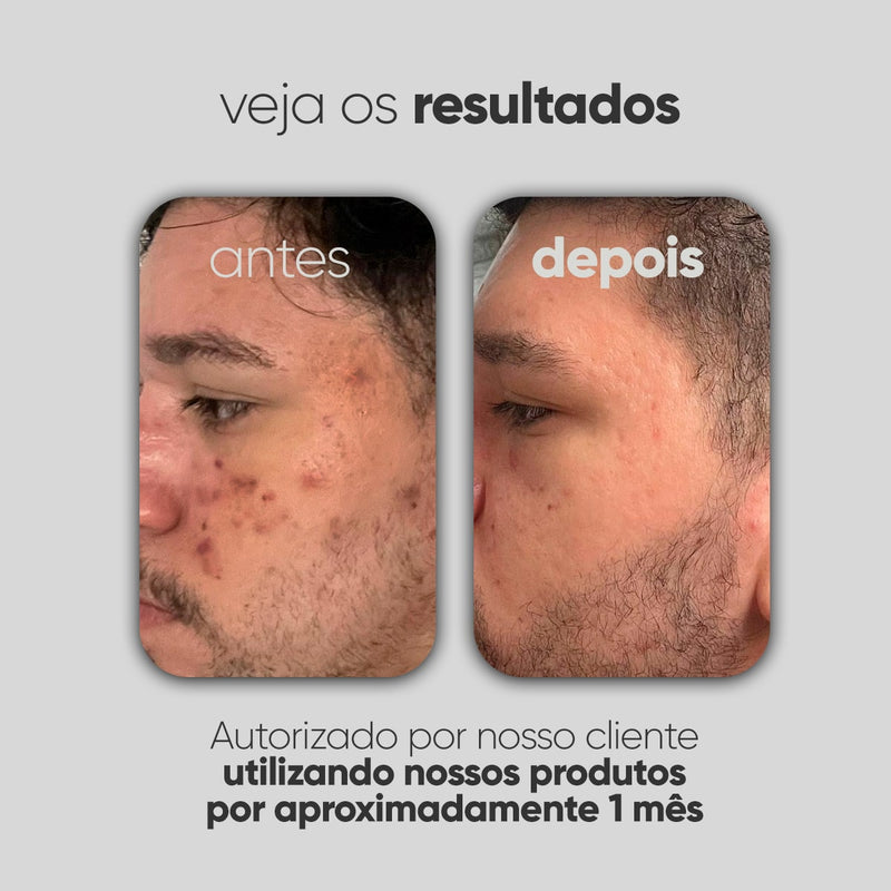 Kit Personalizado TI3JH854D01