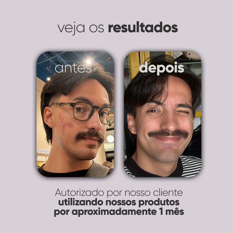 Kit Personalizado TI3JH854D04