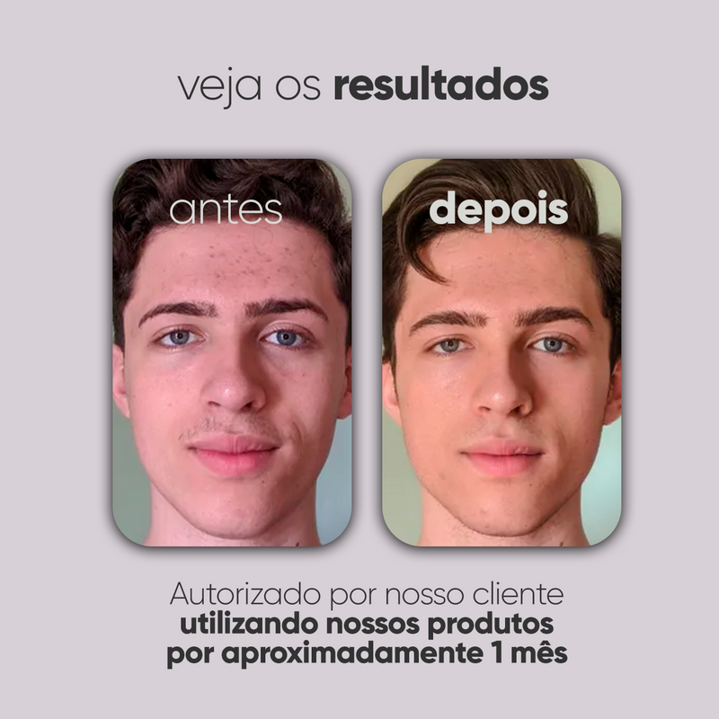Kit Personalizado TI3JH854D03