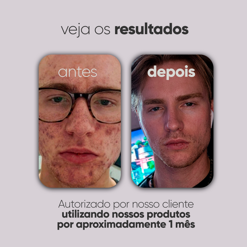 Kit Personalizado TI3JH854D04