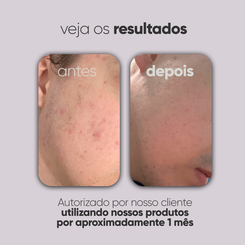 Kit Personalizado TI3JH854D03