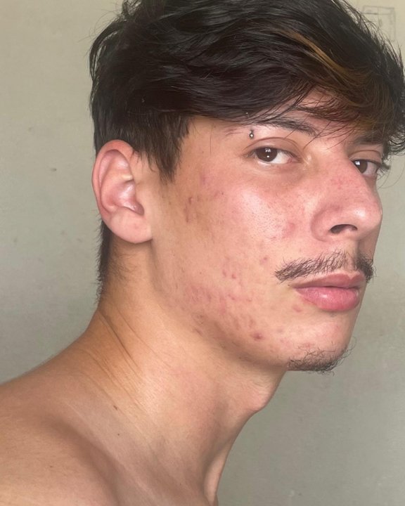 Antes — Mateus Alves