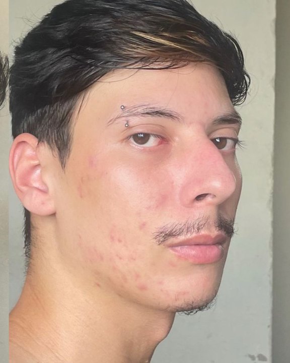 Depois — Mateus Alves