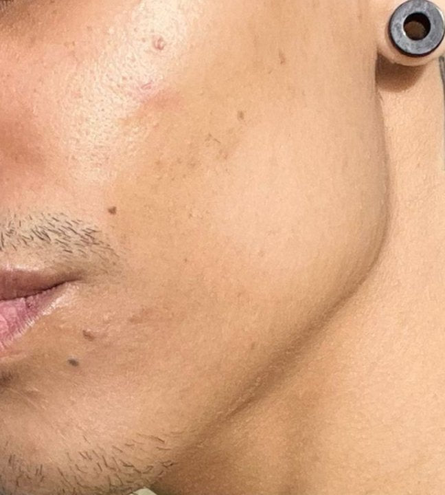 Depois — Luan Lima