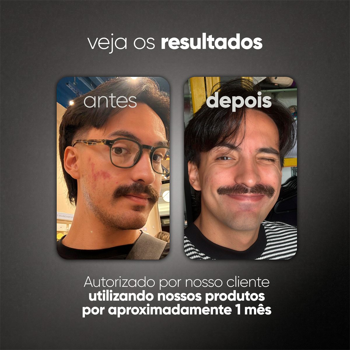 SÉRUM UNIFORMIZADOR - 10% de Niacinamida - 30ml  — foto 6